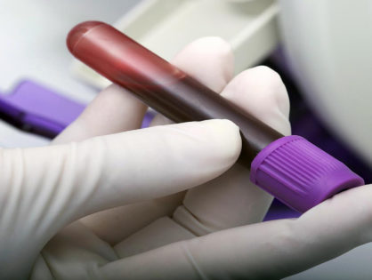 Exame de sangue pode ajuda no diagnóstico precoce de câncer de mama, aponta estudo