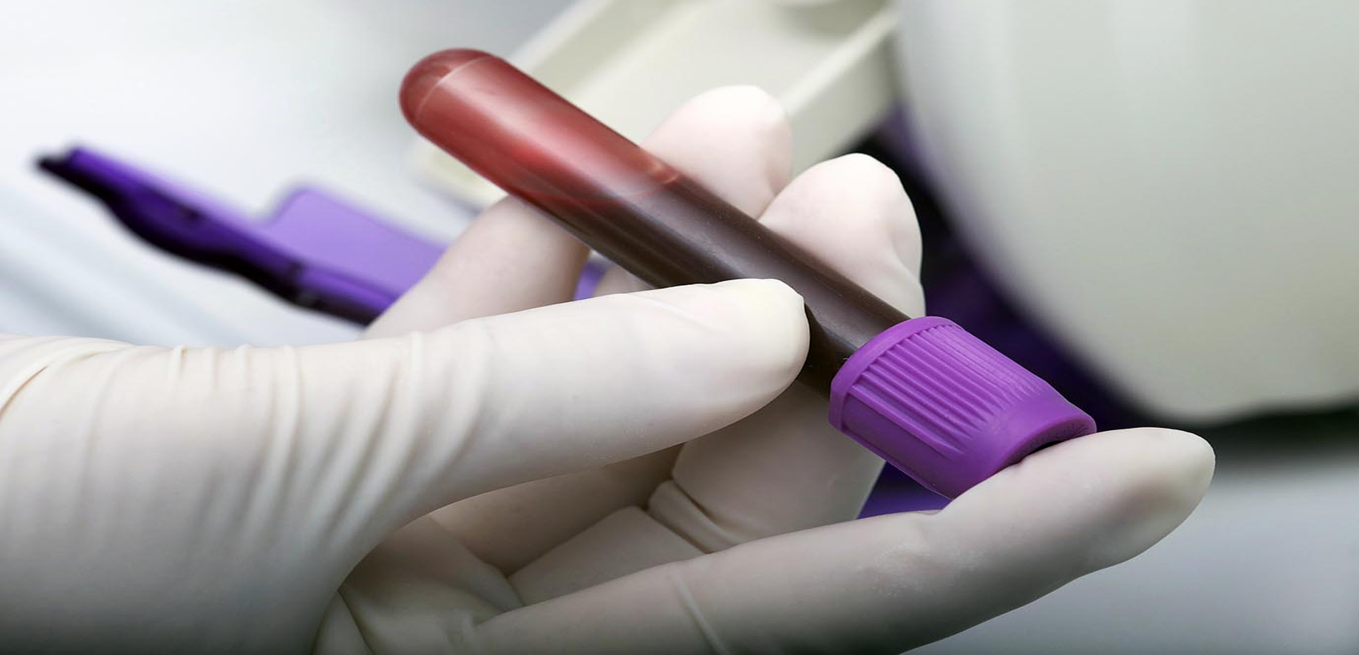 Exame de sangue pode ajuda no diagnóstico precoce de câncer de mama, aponta estudo
