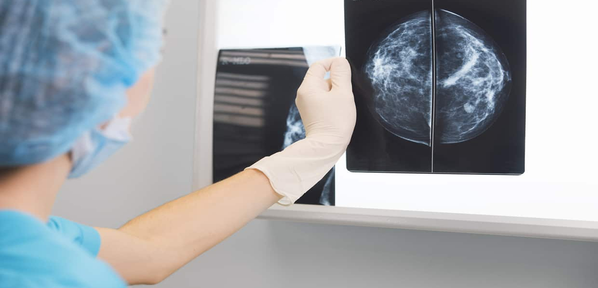 Inteligência artificial melhora diagnóstico do câncer de mama
