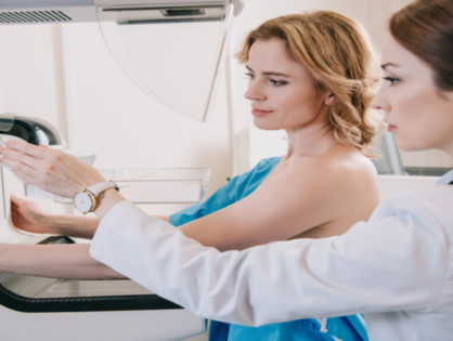 Estudo de câncer reacende debate sobre quando iniciar mamografias periódicas